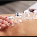 Could Cupping Therapy Improve Circadian Rhythm?
