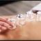 Cupping Therapy to improve body's internal clock