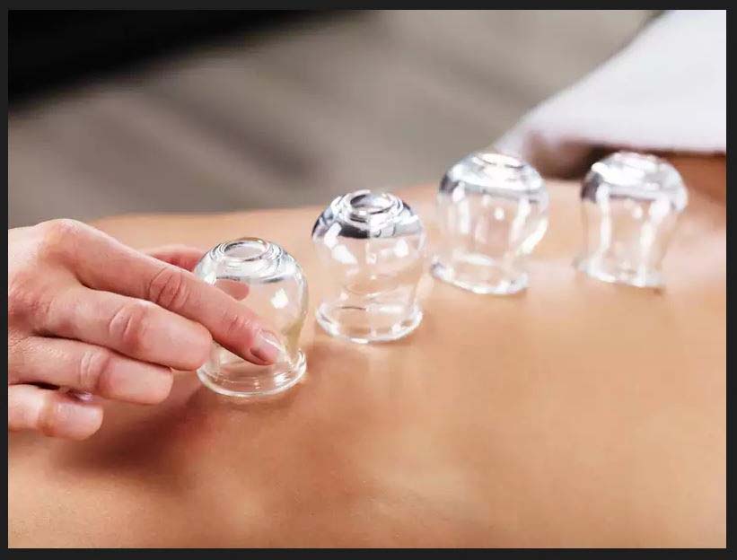 Cupping Therapy to improve body's internal clock